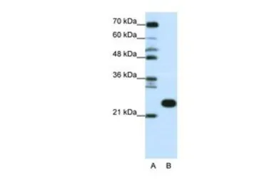 Anti-RPL13 antibody, C-term used in Western Blot (WB). GTX47430