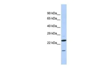 Anti-INSIG2 antibody, N-term used in Western Blot (WB). GTX47435