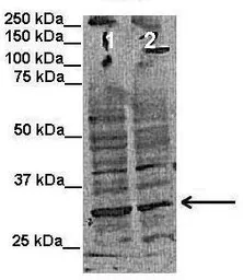 Anti-INSIG1 antibody, Internal used in Western Blot (WB). GTX47438
