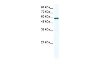 Anti-G3BP1 antibody used in Western Blot (WB). GTX47441