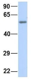 Anti-KCNV1 antibody, N-term used in Western Blot (WB). GTX47444