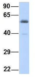 Anti-KCNV1 antibody, N-term used in Western Blot (WB). GTX47444