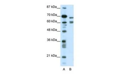 Anti-KCNK5 antibody, C-term used in Western Blot (WB). GTX47446