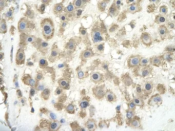 Anti-Glypican-3 antibody, Internal used in IHC (Paraffin sections) (IHC-P). GTX47449