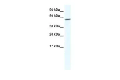 Anti-Glypican-3 antibody, Internal used in Western Blot (WB). GTX47449