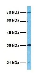 Anti-Glypican-3 antibody, Internal used in Western Blot (WB). GTX47449