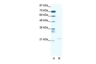 Anti-TRPM3 antibody, N-term used in Western Blot (WB). GTX47453