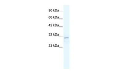 Anti-TRPM3 antibody, N-term used in Western Blot (WB). GTX47454