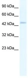 Anti-ZBP1 antibody, Internal used in Western Blot (WB). GTX47462
