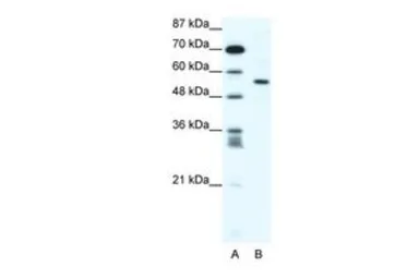 Anti-RUNX2 antibody, Internal used in Western Blot (WB). GTX47467