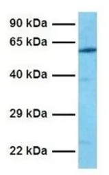 Anti-RUNX2 antibody, Internal used in Western Blot (WB). GTX47467