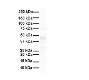 Anti-MCM9 antibody, N-term used in Western Blot (WB). GTX47470