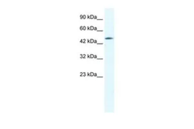 Anti-Connexin 40.1 antibody, C-term used in Western Blot (WB). GTX47476