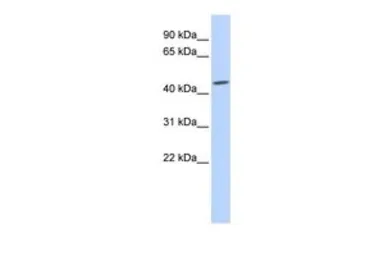 Anti-GJC2 antibody, Internal used in Western Blot (WB). GTX47484