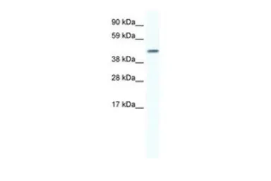 Anti-Connexin 40 antibody, N-term used in Western Blot (WB). GTX47486