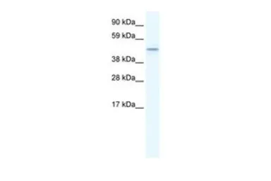 Anti-TMEM108 antibody, Internal used in Western Blot (WB). GTX47500