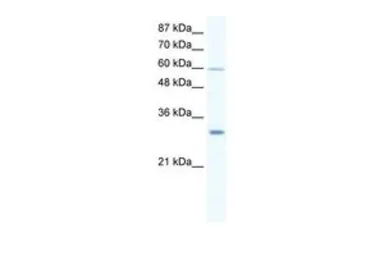 Anti-DDX31 antibody, N-term used in Western Blot (WB). GTX47501