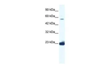 Anti-DDX55 antibody, C-term used in Western Blot (WB). GTX47503