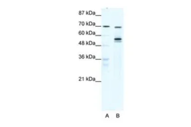 Anti-DDX55 antibody, N-term used in Western Blot (WB). GTX47504