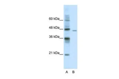 Anti-DDX25 antibody, C-term used in Western Blot (WB). GTX47517