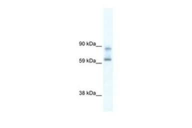 Anti-DDX42 antibody, N-term used in Western Blot (WB). GTX47520