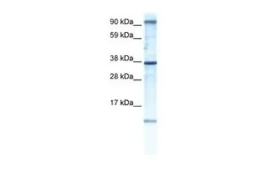 Anti-AKAP7 antibody, N-term used in Western Blot (WB). GTX47526