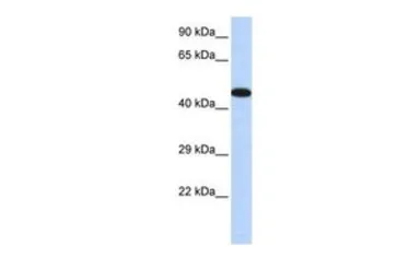 Anti-AKAP5 antibody, Internal used in Western Blot (WB). GTX47530