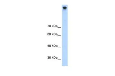Anti-TRPM3 antibody, N-term used in Western Blot (WB). GTX47533