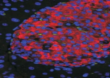 Anti-UNC5C antibody, Internal used in IHC (Paraffin sections) (IHC-P). GTX47544