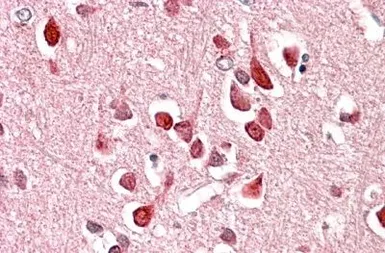 Anti-UNC5C antibody, Internal used in IHC (Paraffin sections) (IHC-P). GTX47544