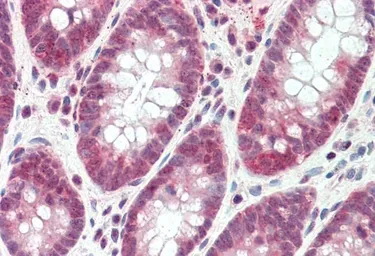 Anti-SH2D3A antibody, Internal used in IHC (Paraffin sections) (IHC-P). GTX47545