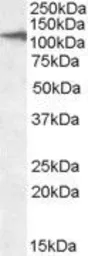 Anti-CLEC16A (aa1040-53) antibody, C-term used in Western Blot (WB). GTX47546