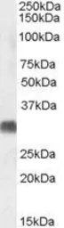 Anti-SRD5A2 antibody, C-term used in Western Blot (WB). GTX47547