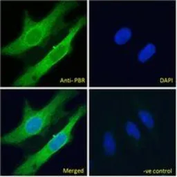 Anti-PBR antibody, C-term used in Immunocytochemistry/ Immunofluorescence (ICC/IF). GTX47548