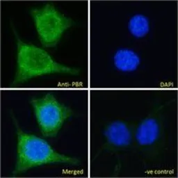 Anti-PBR antibody, C-term used in Immunocytochemistry/ Immunofluorescence (ICC/IF). GTX47548
