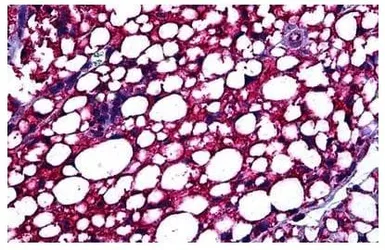 Anti-PBR antibody, C-term used in IHC (Paraffin sections) (IHC-P). GTX47548