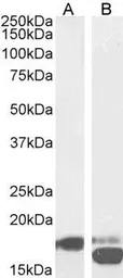 Anti-PBR antibody, C-term used in Western Blot (WB). GTX47548