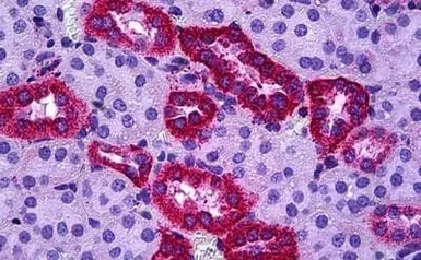 Anti-PBR antibody, C-term used in IHC (Paraffin sections) (IHC-P). GTX47548