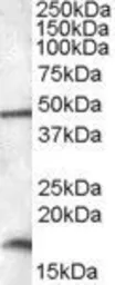 Anti-RBM3 antibody, C-term used in Western Blot (WB). GTX47550