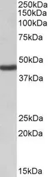 Anti-KCNJ1 / ROMK antibody, Internal used in Western Blot (WB). GTX47558
