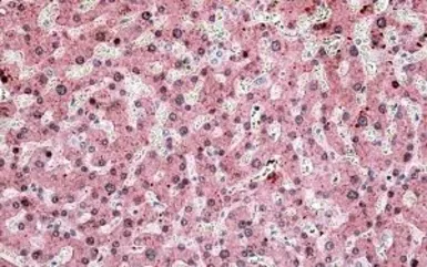 Anti-ITIH4 antibody, Internal used in IHC (Paraffin sections) (IHC-P). GTX47566