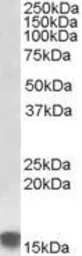 Anti-SRX1 antibody, Internal used in Western Blot (WB). GTX47573
