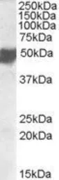 Anti-CLMP antibody, C-term used in Western Blot (WB). GTX47579