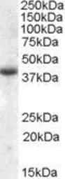 Anti-Apolipoprotein L6 antibody, Internal used in Western Blot (WB). GTX47580