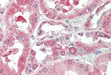 Anti-KIF6 antibody, Internal used in IHC (Paraffin sections) (IHC-P). GTX47581