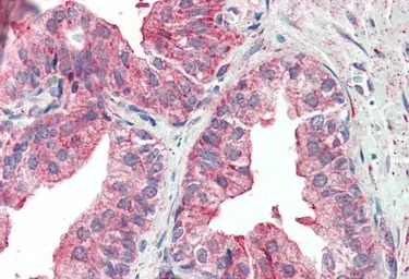 Anti-KIF6 antibody, Internal used in IHC (Paraffin sections) (IHC-P). GTX47581