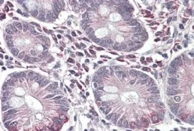 Anti-ASBT antibody, C-term used in IHC (Paraffin sections) (IHC-P). GTX47585