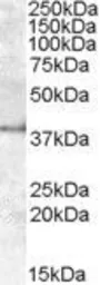 Anti-Apolipoprotein L6 antibody, Internal (near N-term) used in Western Blot (WB). GTX47586