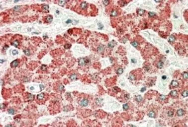 Anti-Apolipoprotein L6 antibody, Internal (near N-term) used in IHC (Paraffin sections) (IHC-P). GTX47586