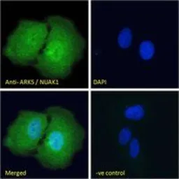 Anti-ARK5 antibody, Internal used in Immunocytochemistry/ Immunofluorescence (ICC/IF). GTX47589